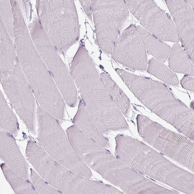 CD45 Antibody (CL0160) - Azide and BSA Free Immunohistochemistry-Paraffin: CD45 Antibody [NBP3-44489]