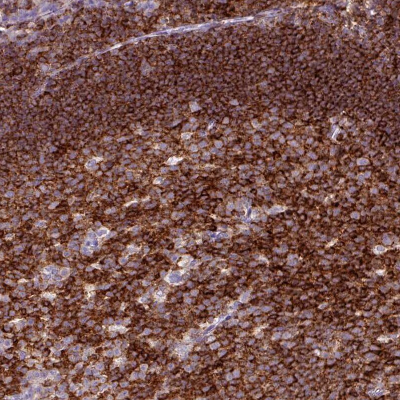 CD45 Antibody (CL0160) - Azide and BSA Free Immunohistochemistry-Paraffin: CD45 Antibody [NBP3-44489]