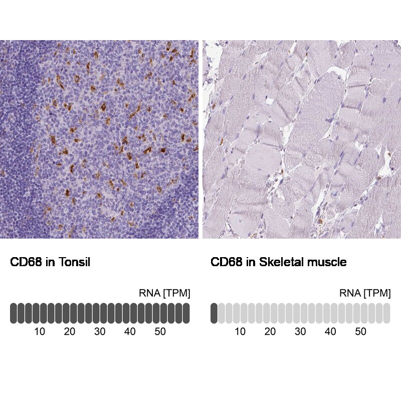 CD68/SR-D1 Antibody (CL1338) - Azide and BSA Free Immunohistochemistry-Paraffin: CD68/SR-D1 Antibody [NBP3-44490]