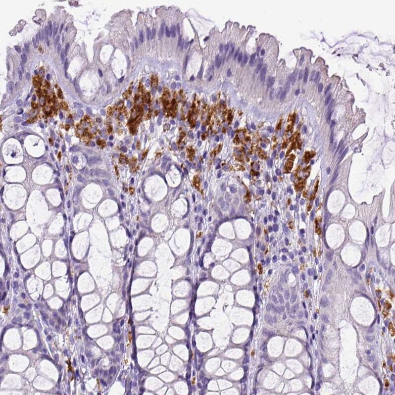 CD68/SR-D1 Antibody (CL1338) - Azide and BSA Free Immunohistochemistry-Paraffin: CD68/SR-D1 Antibody [NBP3-44490]