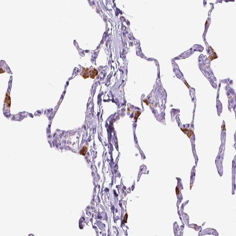 CD68/SR-D1 Antibody (CL1338) - Azide and BSA Free Immunohistochemistry-Paraffin: CD68/SR-D1 Antibody [NBP3-44490]