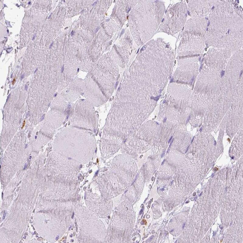 CD68/SR-D1 Antibody (CL1338) - Azide and BSA Free Immunohistochemistry-Paraffin: CD68/SR-D1 Antibody [NBP3-44490]