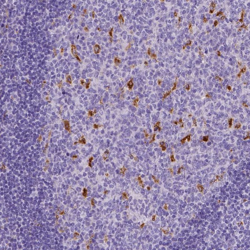 CD68/SR-D1 Antibody (CL1338) - Azide and BSA Free Immunohistochemistry-Paraffin: CD68/SR-D1 Antibody [NBP3-44490]