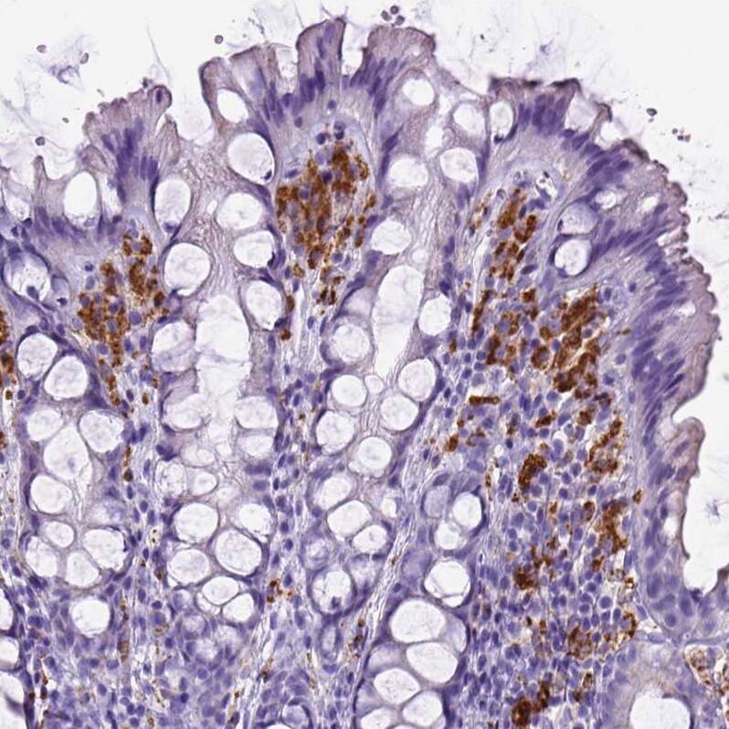 CD68/SR-D1 Antibody (CL1346) - Azide and BSA Free Immunohistochemistry-Paraffin: CD68/SR-D1 Antibody [NBP3-44491]