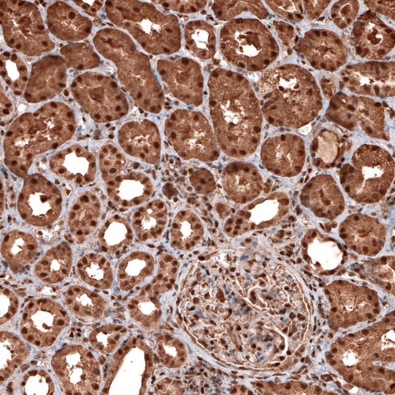 GAPDH Antibody (CL3266) - Azide and BSA Free Immunohistochemistry-Paraffin: GAPDH Antibody [NBP3-44492]