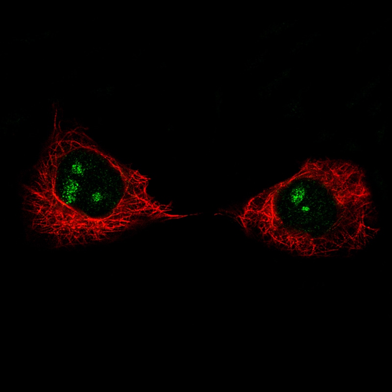 Ki67/MKI67 Antibody (CL1234) - Azide and BSA Free Immunocytochemistry/ Immunofluorescence: Ki67/MKI67 Antibody [NBP3-44494]