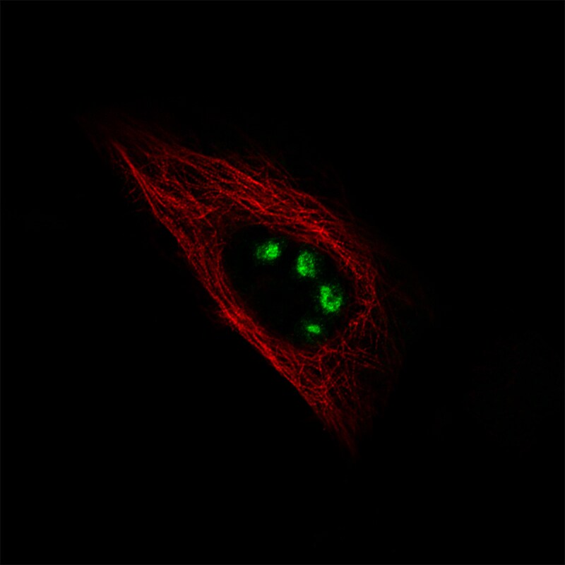 Ki67/MKI67 Antibody (CL1234) - Azide and BSA Free Immunocytochemistry/ Immunofluorescence: Ki67/MKI67 Antibody [NBP3-44494]