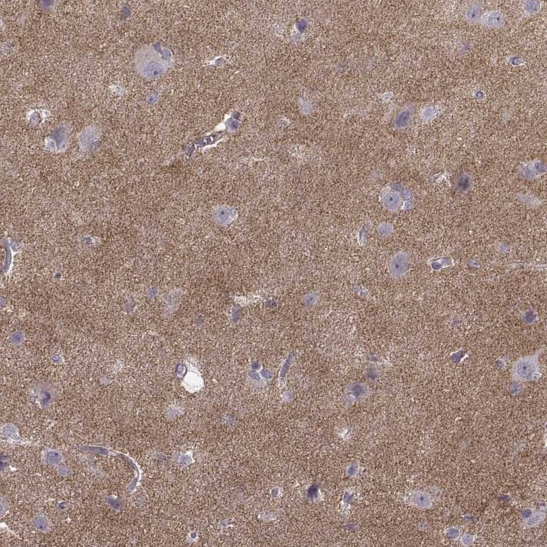N-Cadherin Antibody (CL3716) - Azide and BSA Free Immunohistochemistry-Paraffin: N-Cadherin Antibody [NBP3-44495]
