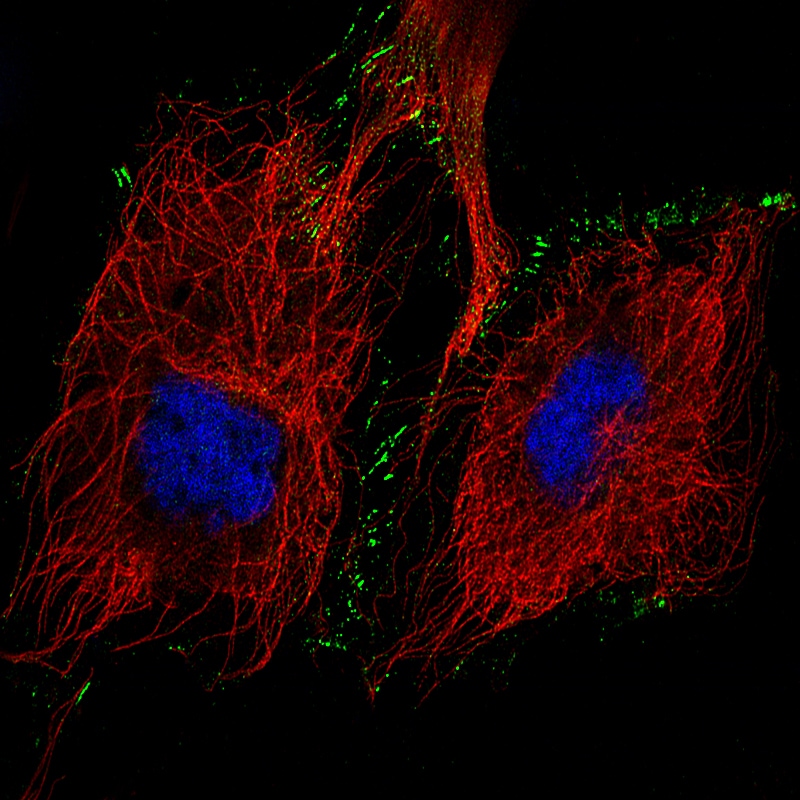 N-Cadherin Antibody (CL3716) - Azide and BSA Free Immunocytochemistry/ Immunofluorescence: N-Cadherin Antibody [NBP3-44495]