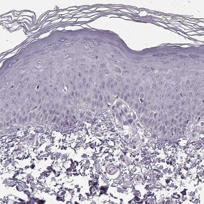 N-Cadherin Antibody (CL3716) - Azide and BSA Free Immunohistochemistry-Paraffin: N-Cadherin Antibody [NBP3-44495]