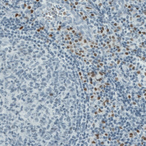 RUNX2/CBFA1 Antibody (CL0232) - Azide and BSA Free Immunohistochemistry-Paraffin: RUNX2/CBFA1 Antibody [NBP3-44496]