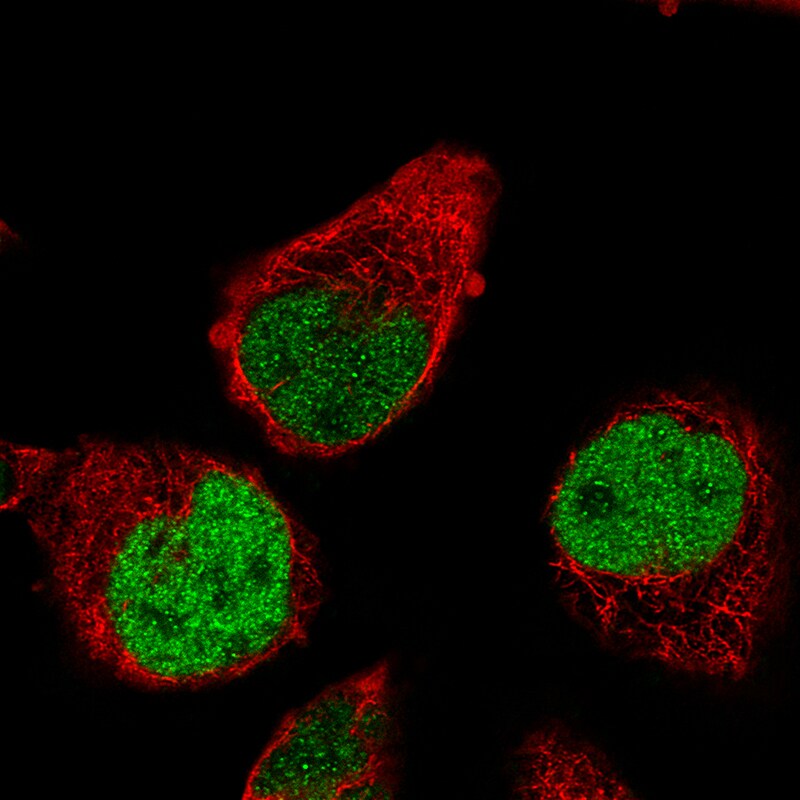 RUNX2/CBFA1 Antibody (CL0232) - Azide and BSA Free Immunocytochemistry/ Immunofluorescence: RUNX2/CBFA1 Antibody [NBP3-44496]