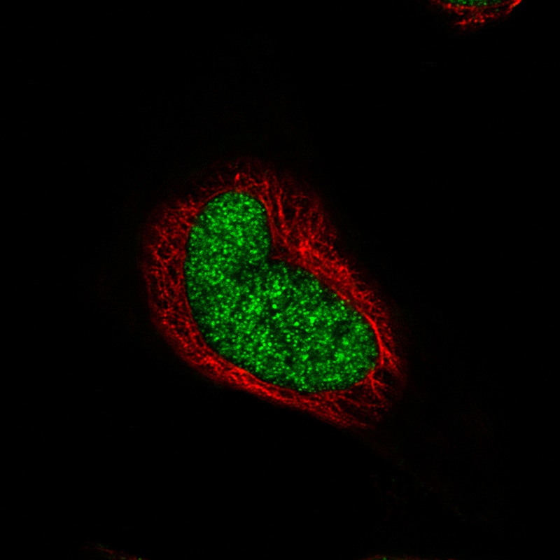 RUNX2/CBFA1 Antibody (CL0235) - Azide and BSA Free Immunocytochemistry/ Immunofluorescence: RUNX2/CBFA1 Antibody [NBP3-44497]