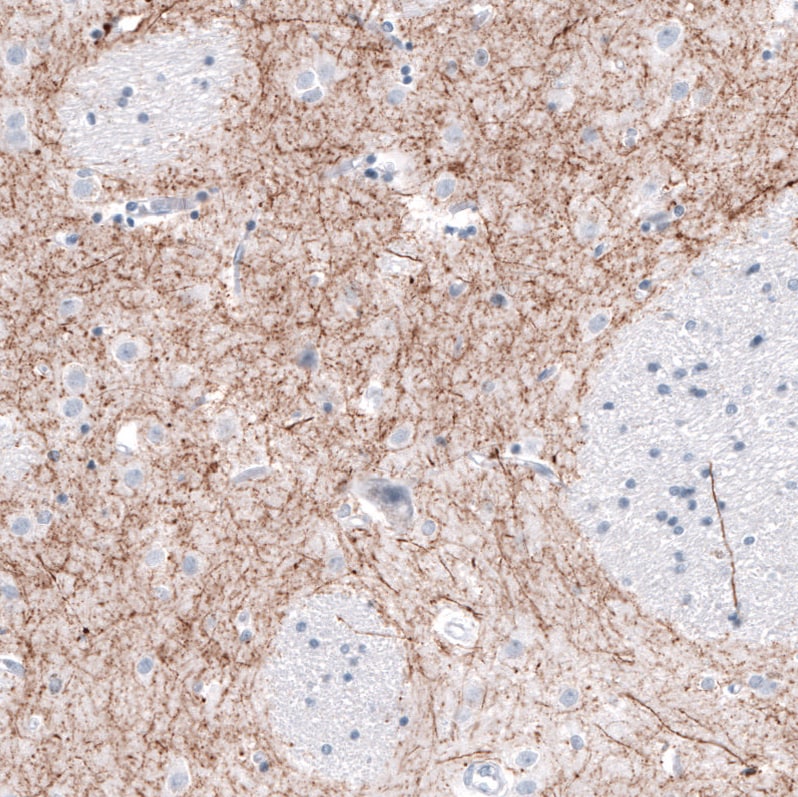 Tyrosine Hydroxylase Antibody (CL3049) - Azide and BSA Free Immunohistochemistry-Paraffin: Tyrosine Hydroxylase Antibody [NBP3-44498]