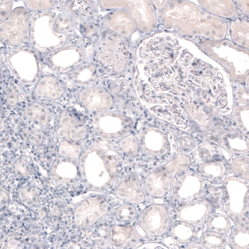 Tyrosine Hydroxylase Antibody (CL3049) - Azide and BSA Free Immunohistochemistry-Paraffin: Tyrosine Hydroxylase Antibody [NBP3-44498]