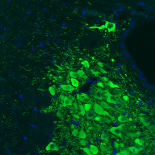 Tyrosine Hydroxylase Antibody (CL3049) - Azide and BSA Free Immunohistochemistry-Paraffin: Tyrosine Hydroxylase Antibody [NBP3-44498]