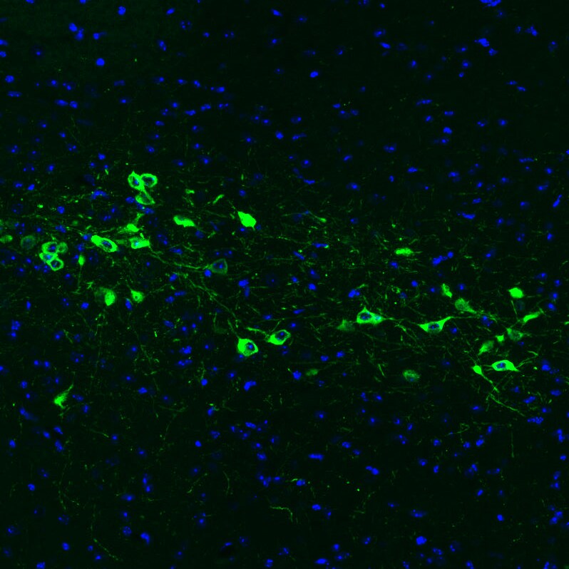 Tyrosine Hydroxylase Antibody (CL3049) - Azide and BSA Free Immunohistochemistry-Paraffin: Tyrosine Hydroxylase Antibody [NBP3-44498]