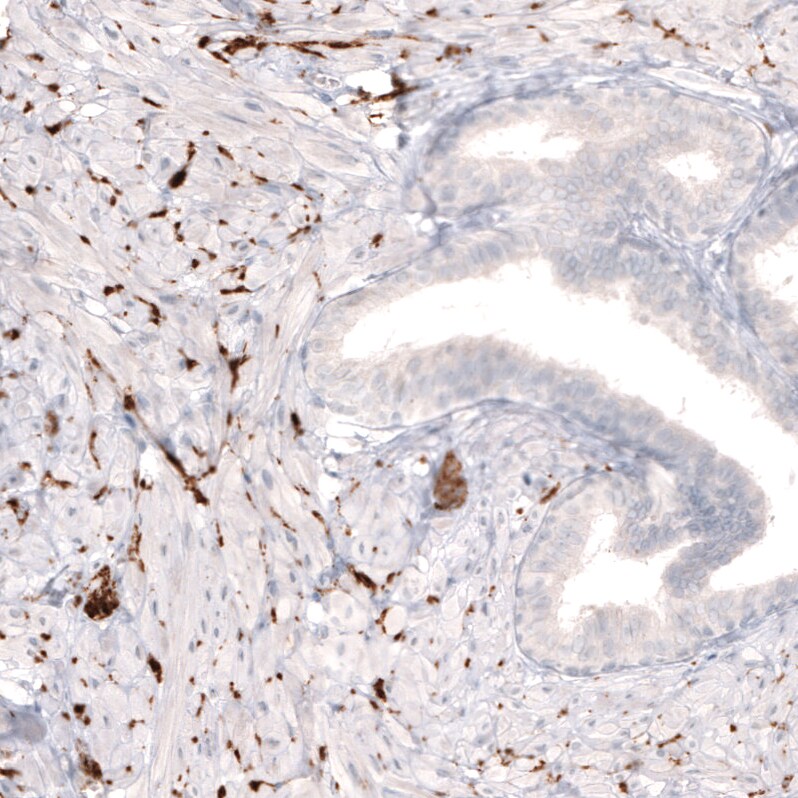 Tyrosine Hydroxylase Antibody (CL3049) - Azide and BSA Free Immunohistochemistry-Paraffin: Tyrosine Hydroxylase Antibody [NBP3-44498]