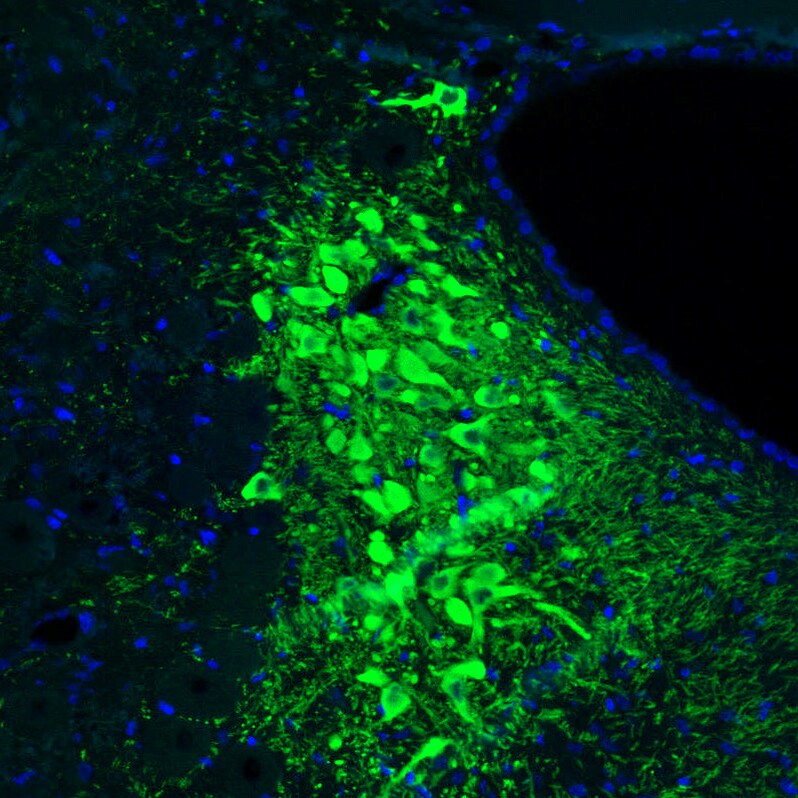 Tyrosine Hydroxylase Antibody (CL3049) - Azide and BSA Free Immunohistochemistry-Paraffin: Tyrosine Hydroxylase Antibody [NBP3-44498]