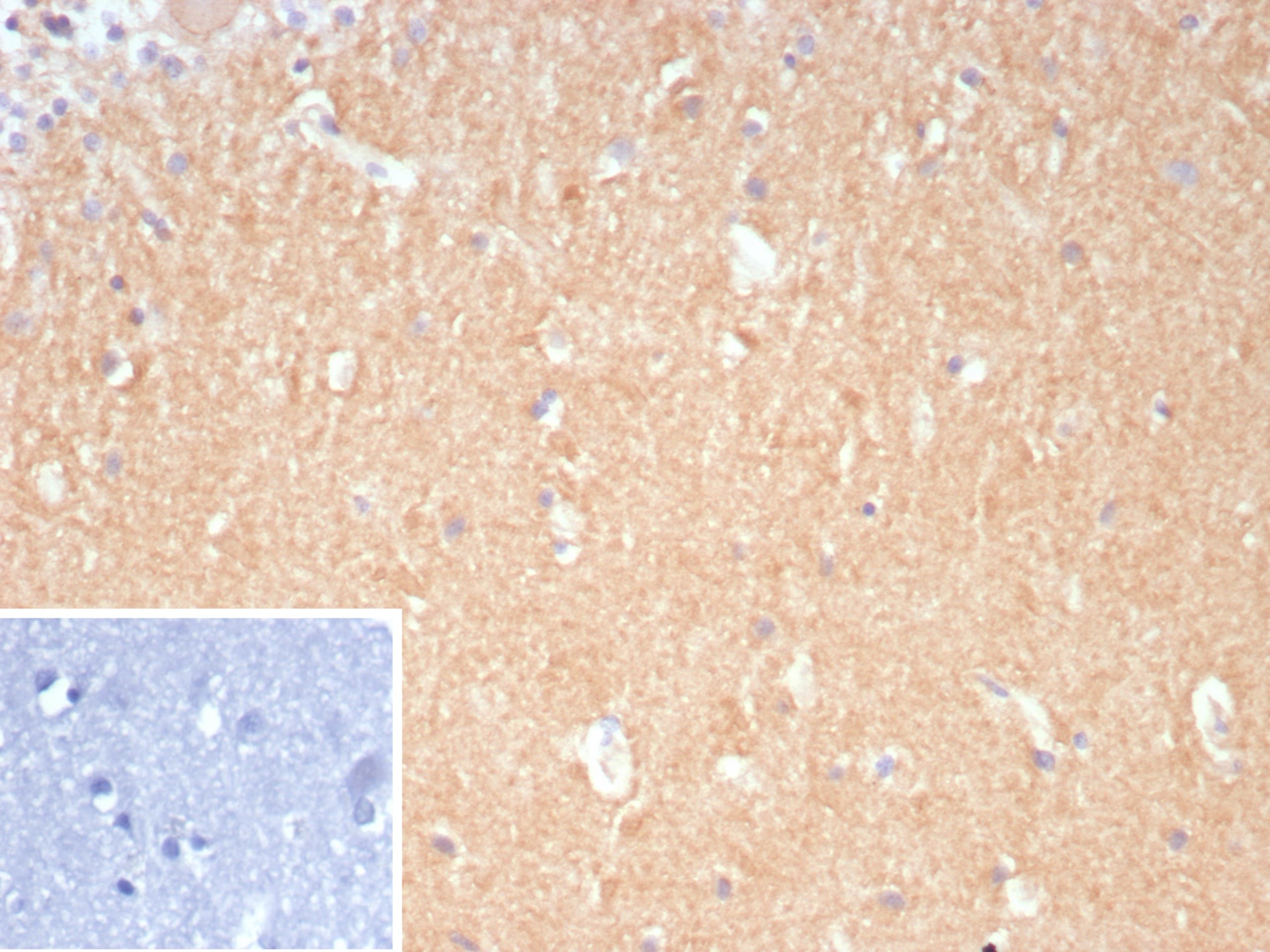 DLL3 Antibody (DLL3/9361)
