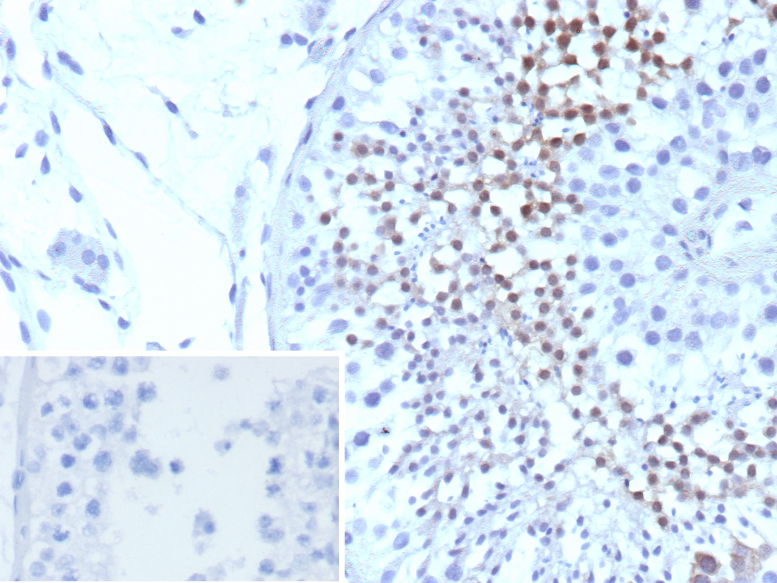 Centrin 1 Antibody (CETN1/9880)