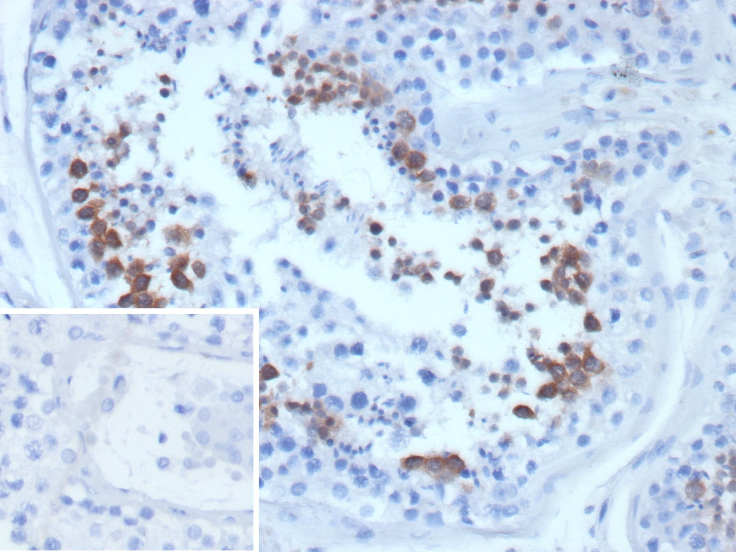 Centrin 1 Antibody (CETN1/9877)