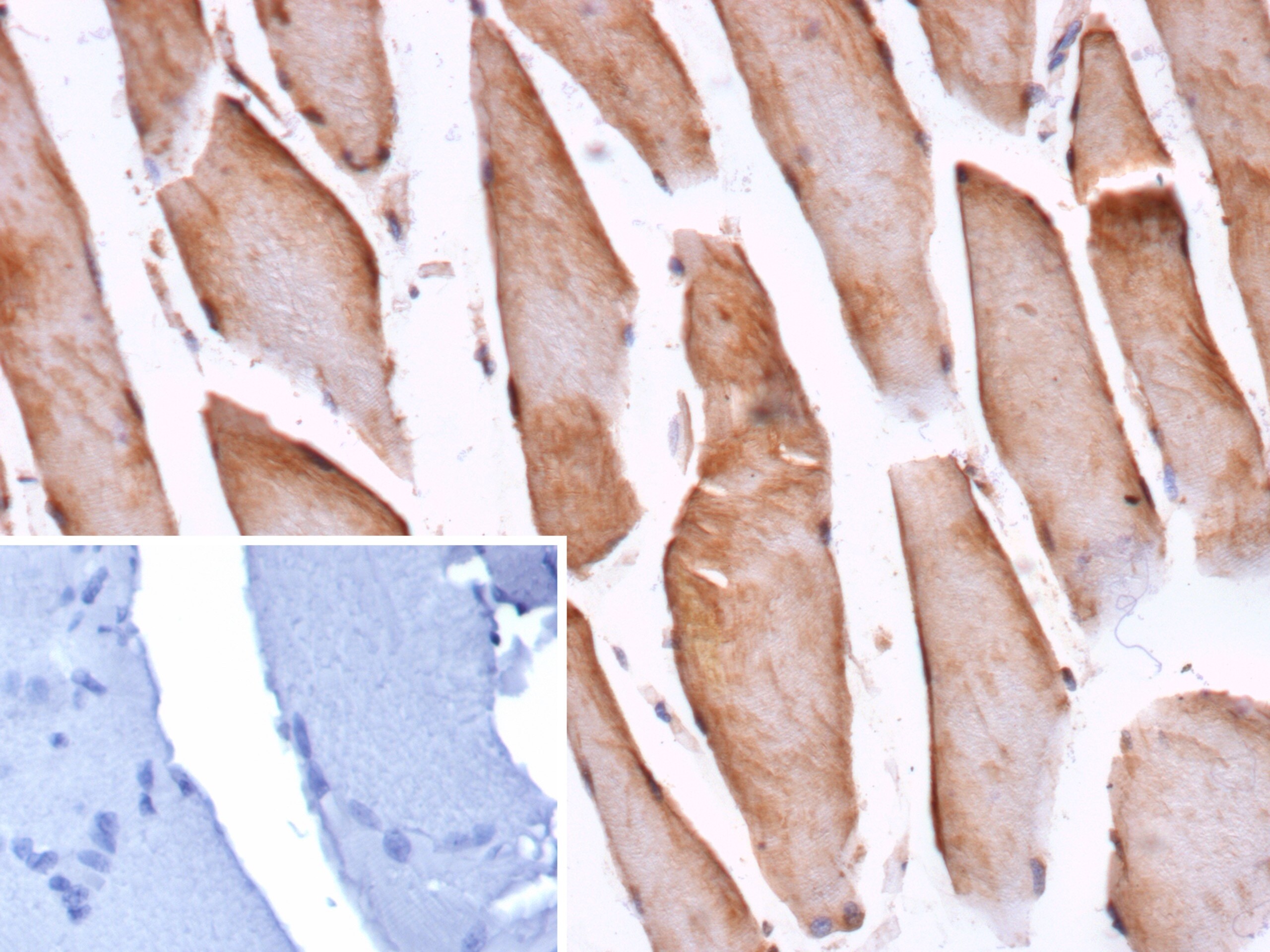 Cofilin 2 Antibody (CFL2/9963)