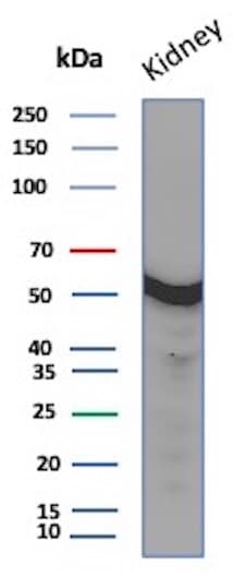Glucose 6 phosphate isomerase Antibody (GPI/2439)