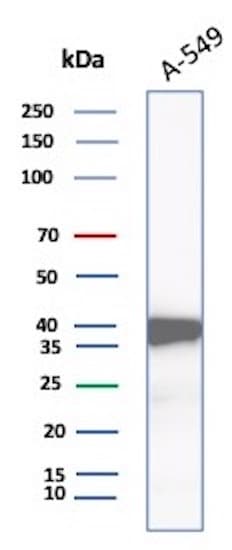 Aldo-keto Reductase 1C1/AKR1C1 Antibody (AKR1C1/9318)