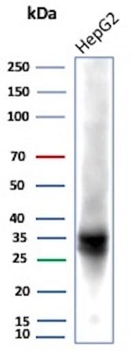 Aldo-keto Reductase 1C1/AKR1C1 Antibody (AKR1C1/9318)