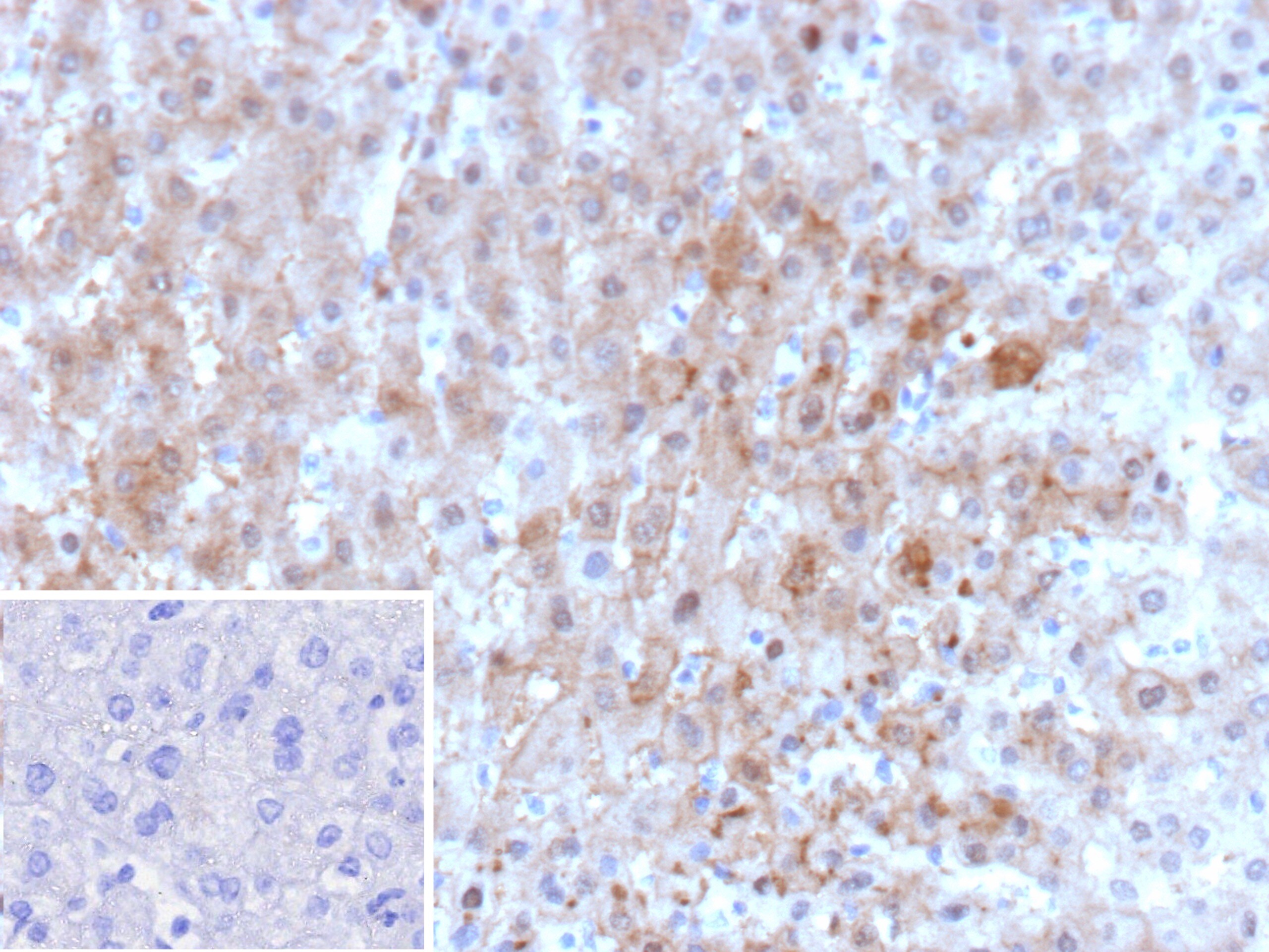 Aldo-keto Reductase 1C1/AKR1C1 Antibody (AKR1C1/9062)