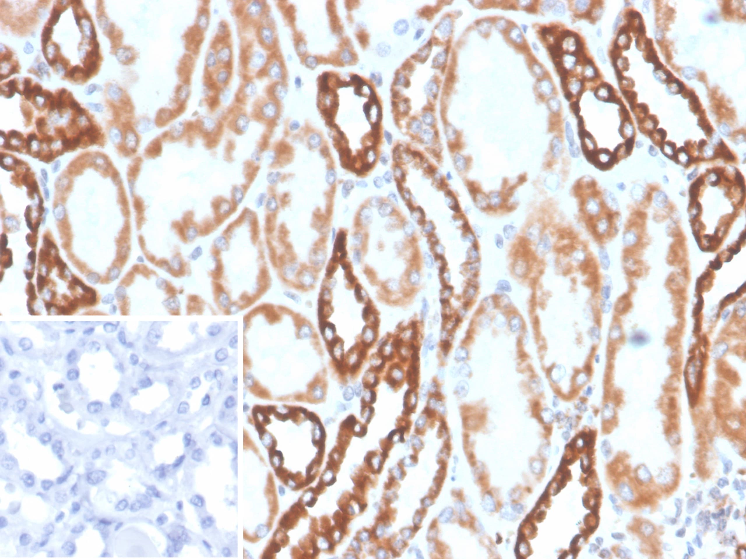 PLA2R1 Antibody (PLA2R1/4894)