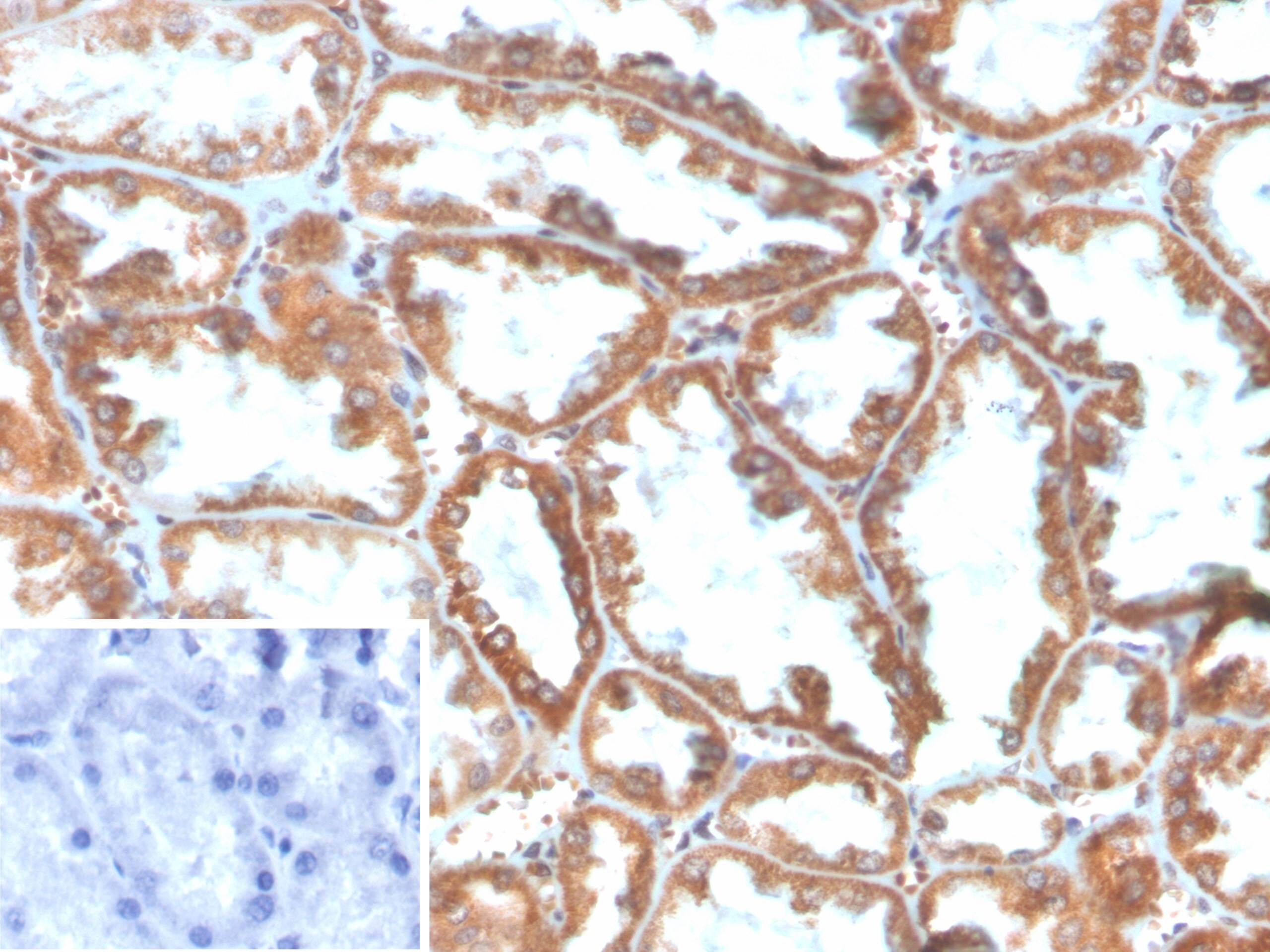 PLA2R1 Antibody (PLA2R1/4897)