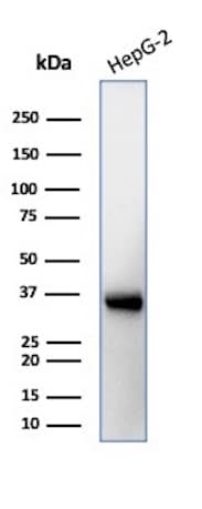 Aquaporin-4 Antibody (AQP4/3323)
