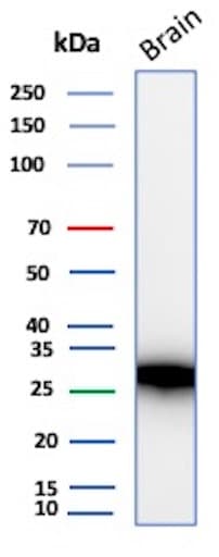 Calbindin D-28K Antibody (rCALB1/13280)