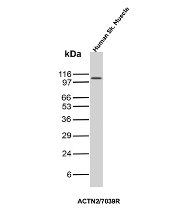 Alpha Actinin 2 Antibody (ACTN2/7039R)