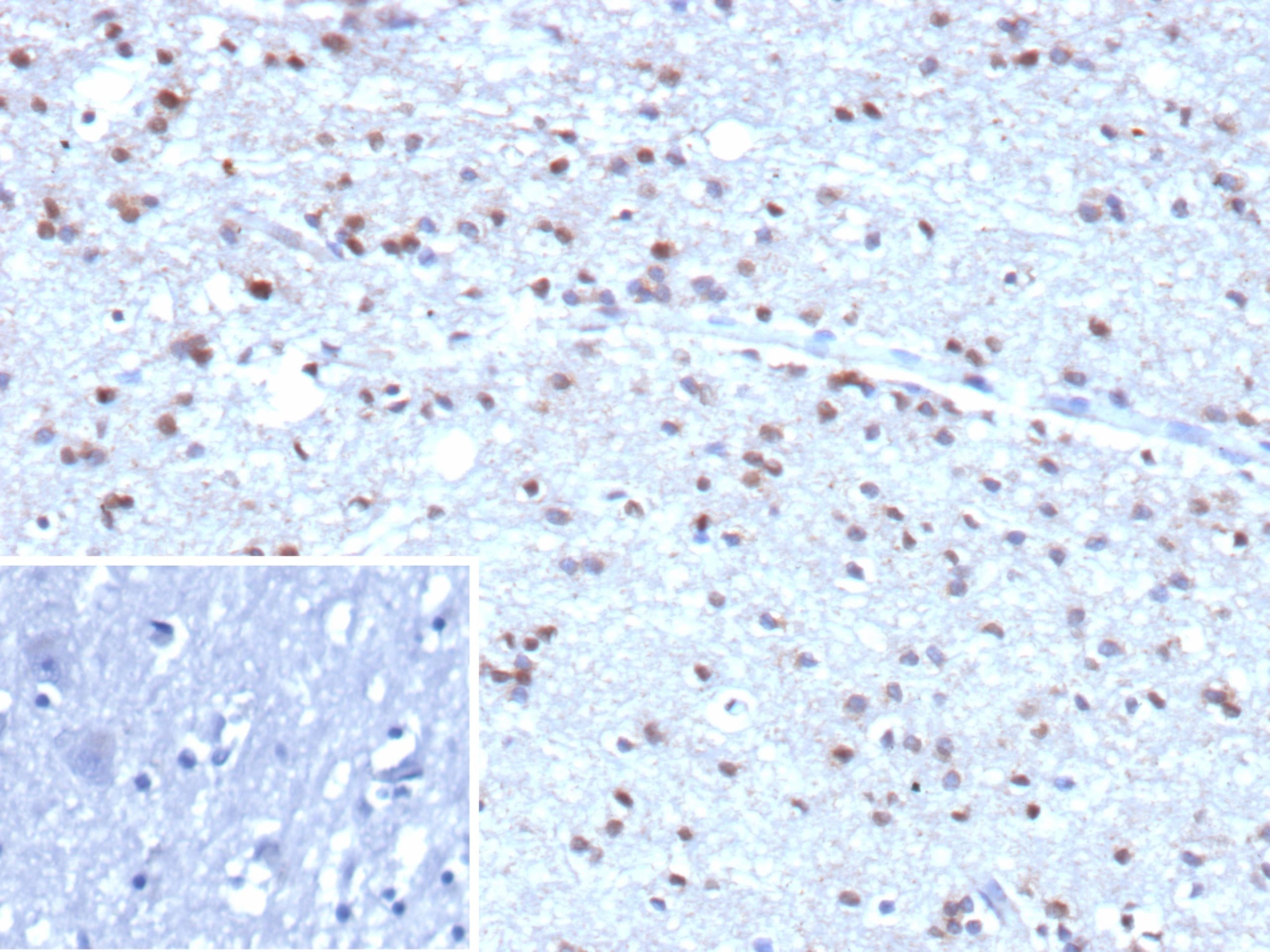 Ubiquitin B Antibody (rUBB/9476)