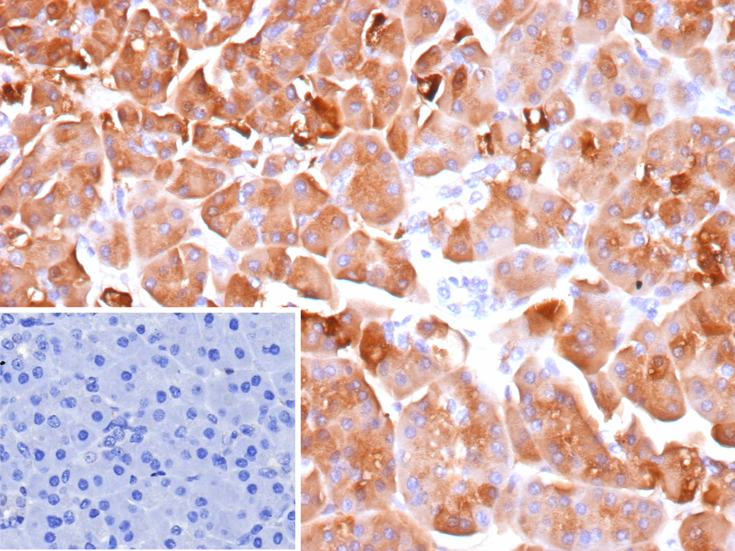 ELA3A Antibody (CELA3A/12552)