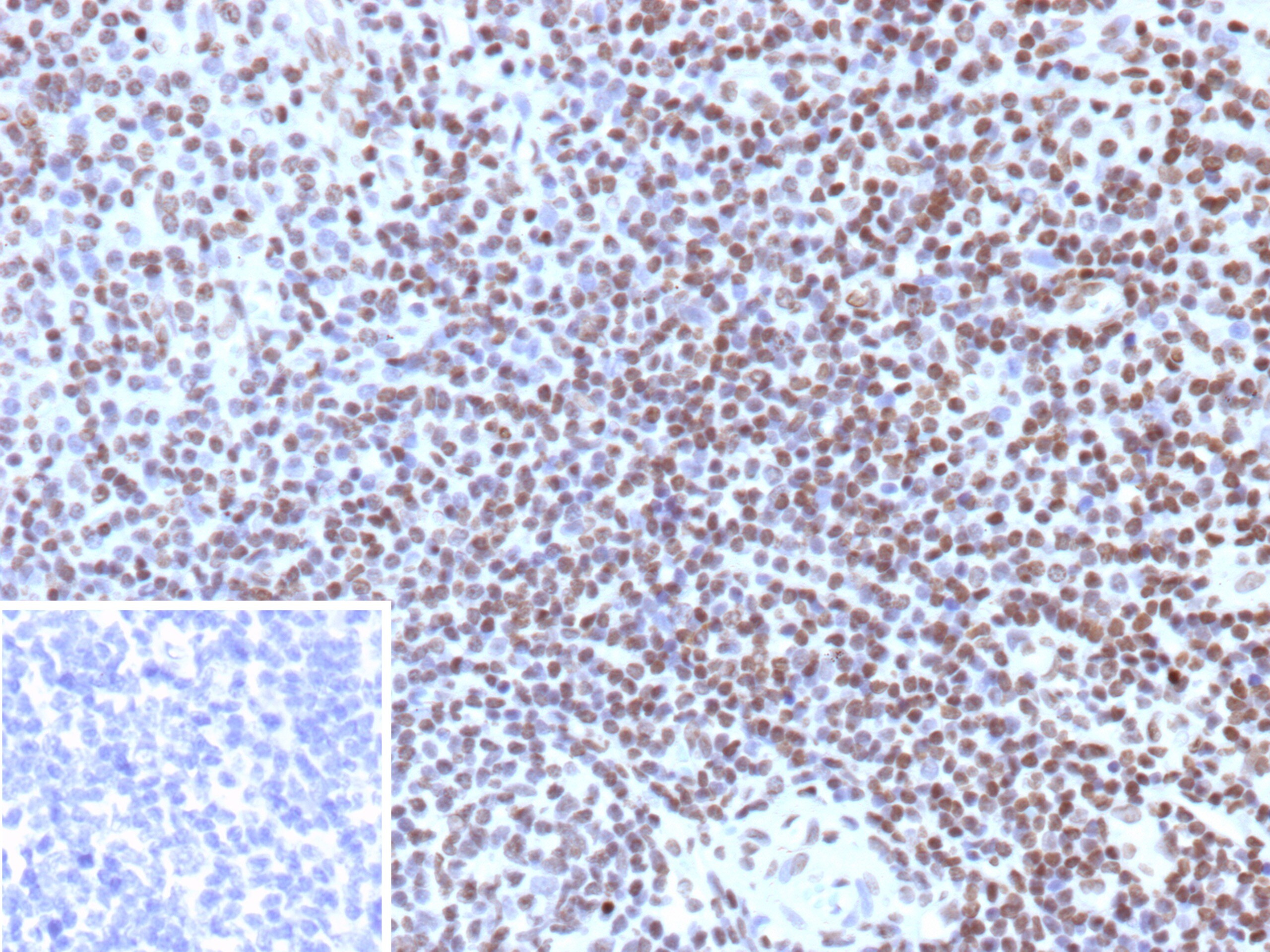 Histone H3.1 [p Ser10] Antibody (rHH3/9924)