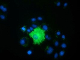 PEX5 Antibody (OTI6C4) Immunocytochemistry/ Immunofluorescence;PEX5 Antibody (OTI6C4)[NBP3-44634]-
