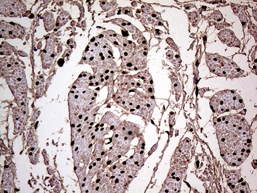 MEIS1 Antibody (OTI1B4) Immunohistochemistry;MEIS1 Antibody (OTI1B4)[NBP3-44795]-