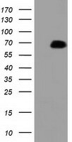 PEX5 Antibody (OTI6G8) Western Blot;PEX5 Antibody (OTI6G8)[NBP3-44635]-