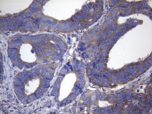 Cytohesin 2 Antibody (OTI4D9) Immunohistochemistry;Cytohesin 2 Antibody (OTI4D9)[NBP3-44913]-