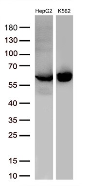 Pyruvate Kinase Antibody (OTI1H4) Western Blot;Pyruvate Kinase Antibody (OTI1H4)[NBP3-44636]-