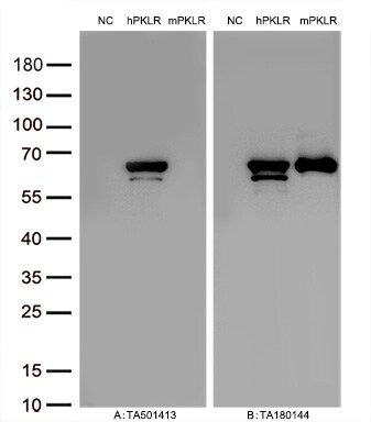 Pyruvate Kinase Antibody (OTI1H4) Western Blot;Pyruvate Kinase Antibody (OTI1H4)[NBP3-44636]-