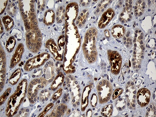 GRB7 Antibody (OTI6H2) Immunohistochemistry;GRB7 Antibody (OTI6H2)[NBP3-44728]-