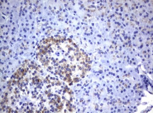 NEU-1/Sialidase-1 Antibody (OTI3B3) Immunohistochemistry;NEU-1/Sialidase-1 Antibody (OTI3B3)[NBP3-44669]-