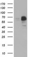 PEX5 Antibody (OTI6E9) Western Blot;PEX5 Antibody (OTI6E9)[NBP3-44637]-