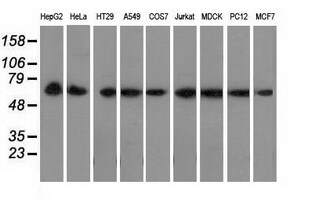 PEX5 Antibody (OTI6E9) Western Blot;PEX5 Antibody (OTI6E9)[NBP3-44637]-