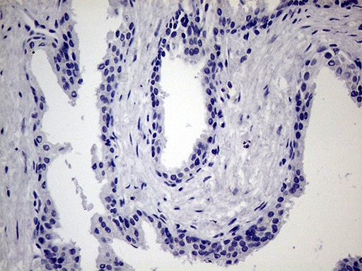 JIP1 Antibody (OTI1D9) Immunohistochemistry;JIP1 Antibody (OTI1D9)[NBP3-44838]-